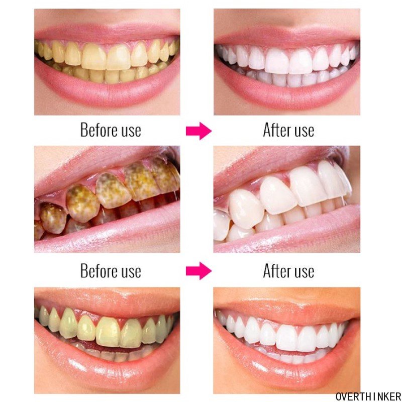 Premium Versatile Ubat Gigi Teeth Whitening Putih Toothpaste White Fresh Breath Niacinamide Toothpaste100g - Image 2