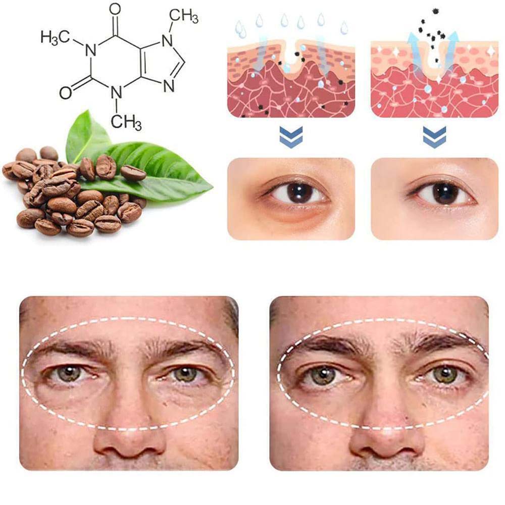 Multi Essential Readystock! 1-5 Pcs OPENEYES Awaken Peptide Lifting Eye Gel - Image 2
