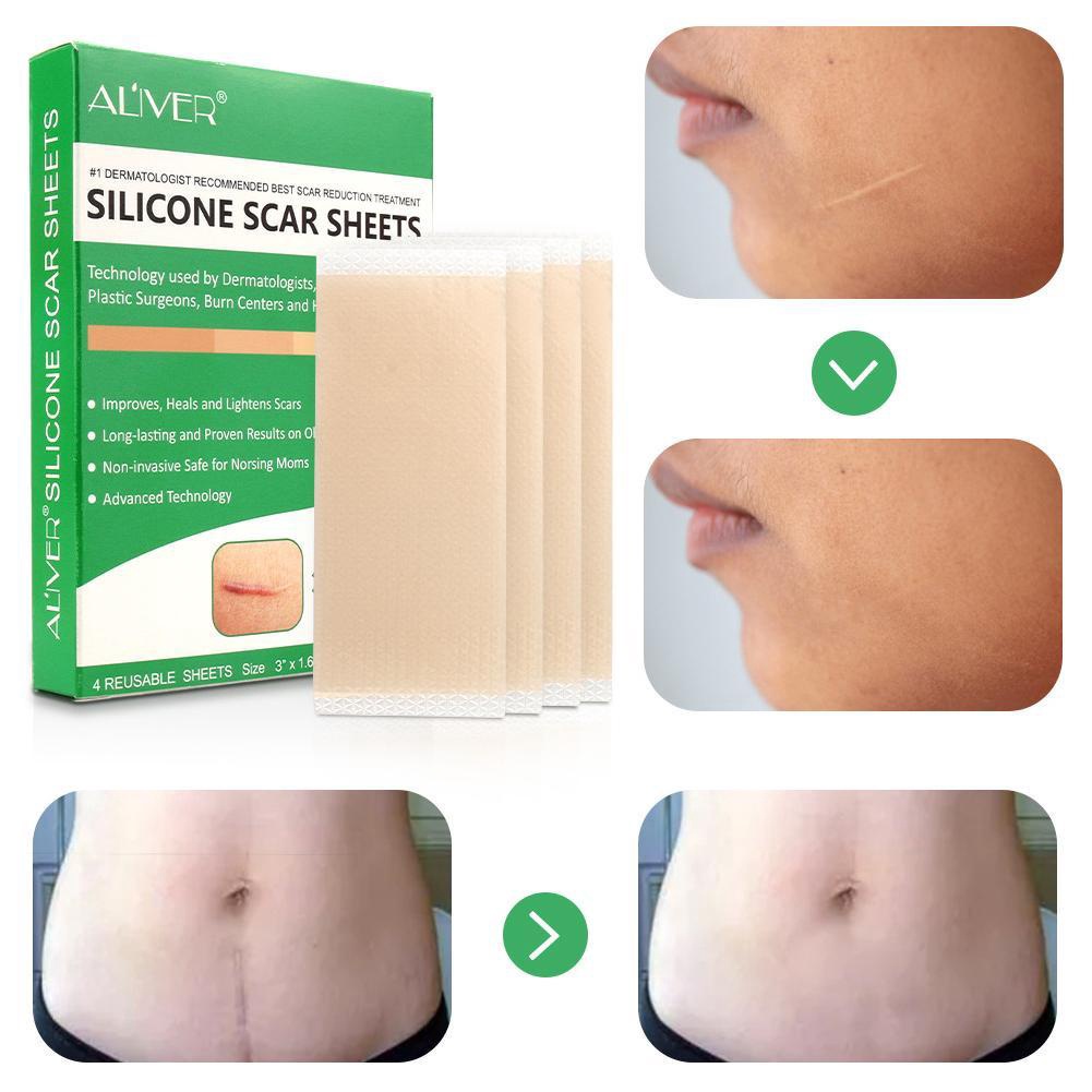 Must Reliable ALIVER Scar Sheets Medical Silicone Gel Strips Patch Tape Sheet Treatm - Image 2