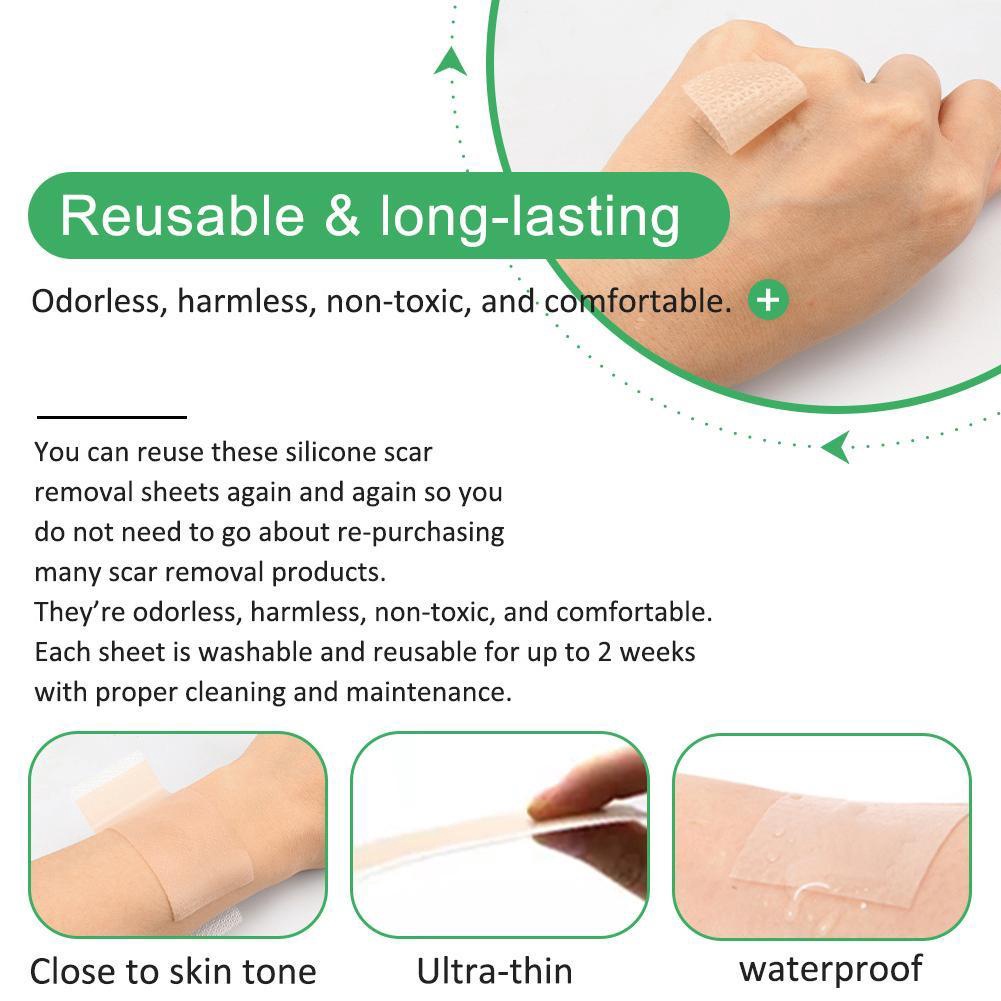 Must Reliable ALIVER Scar Sheets Medical Silicone Gel Strips Patch Tape Sheet Treatm - Image 5