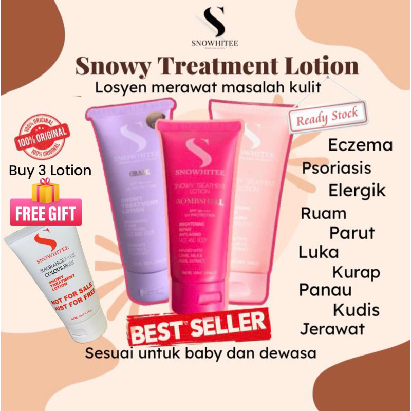 Hot Sale Snowy Treatment Lotion original HQ susu unta merawat eczema, krim gatal kulit, psoriasis, rashes, snowhitee