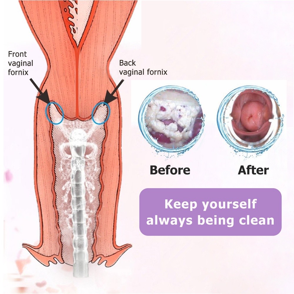 Essential Premium 300ml Vaginal Douche Anal Cleaner Enema Vagina Cleaning Kit Female Washer Women Washing Show Durabl... - Image 2