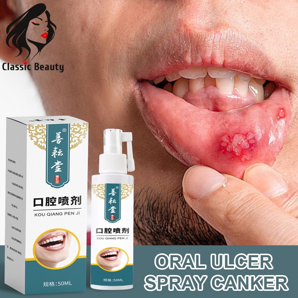 Oral Ulcer Spray Mouth Ulcer Treatment Canker Sore Spray Treatment Pharyngitis Halitosis