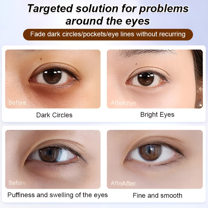 Essential Purpose 【Tulen Rasmi】Minyak Pati Anti-Kedutan dan Anti-Garis Mata SPA | 【VC Lutein Firming Eye Essenc... - Image 2