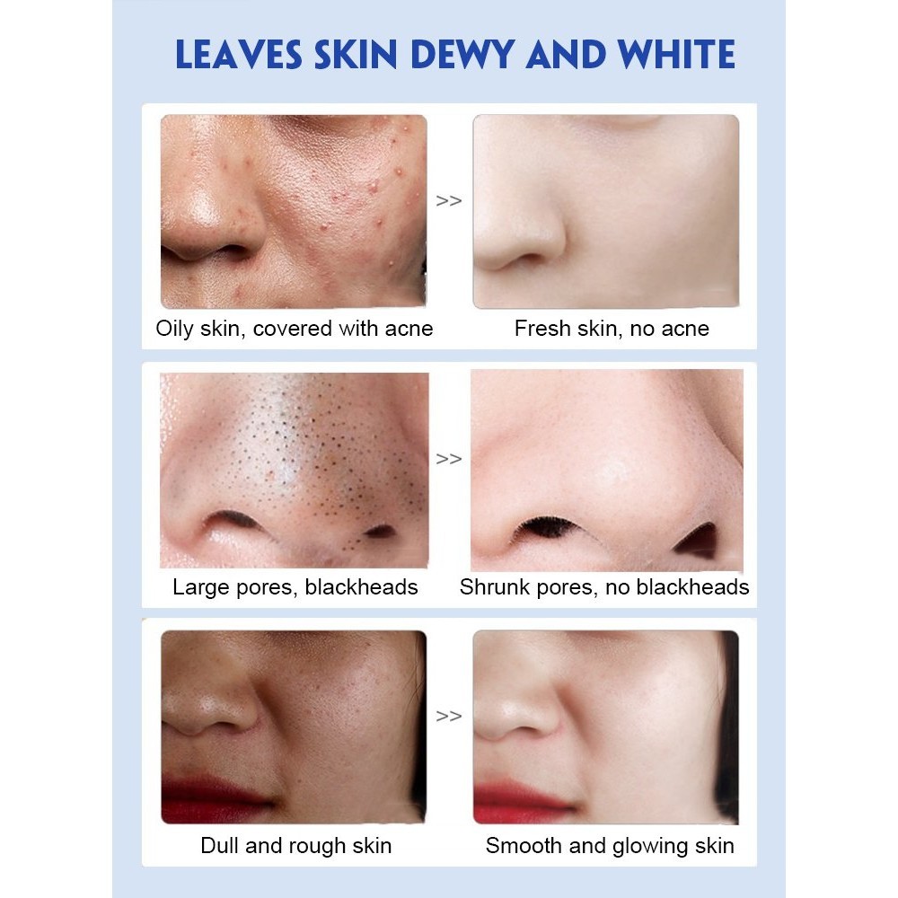 【Orginal Genuine】Darkening Deep Cleansing Niacinamide Oil Control Facial Wash 美白清洁毛孔洗面奶 Kawalan Minyak dan Pembuangan Bl