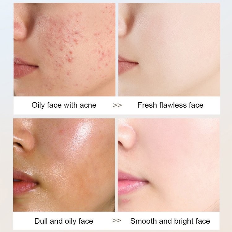 【Orginal Genuine】Darkening Deep Cleansing Niacinamide Oil Control Facial Wash 美白清洁毛孔洗面奶 Kawalan Minyak dan Pembuangan Bl - Image 3