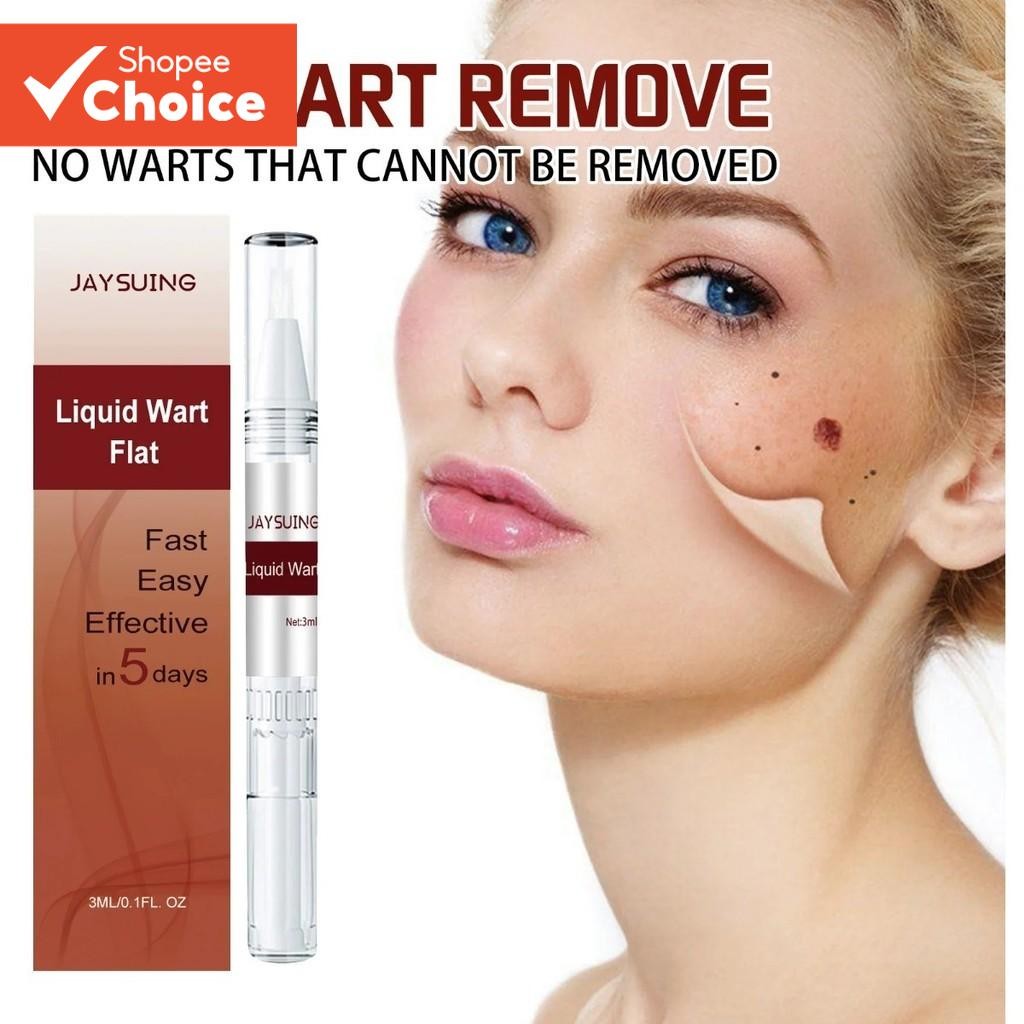 Ke Warts Ointment Pen 3ml Black Mole Remover Wart Removal Skin Repair Lightening Moisturizing Care