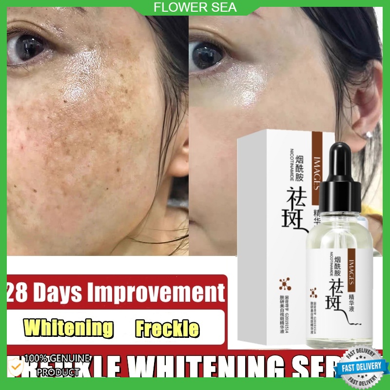 烟酰胺美白祛斑精华液30g Images Anti Freckles Whitening Serum Hydrating Facial Essence Moisturizer Nicotinamide Serum Spot Removing