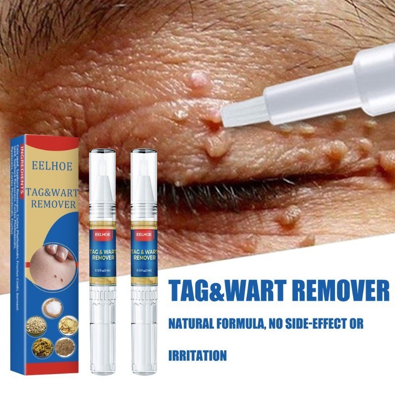 The New Herbal Cream Warmer Remover Mole Remedy Liquid Treatment With Pen Papillomas Skin Flat Labels Genitals Beauty Without Pain