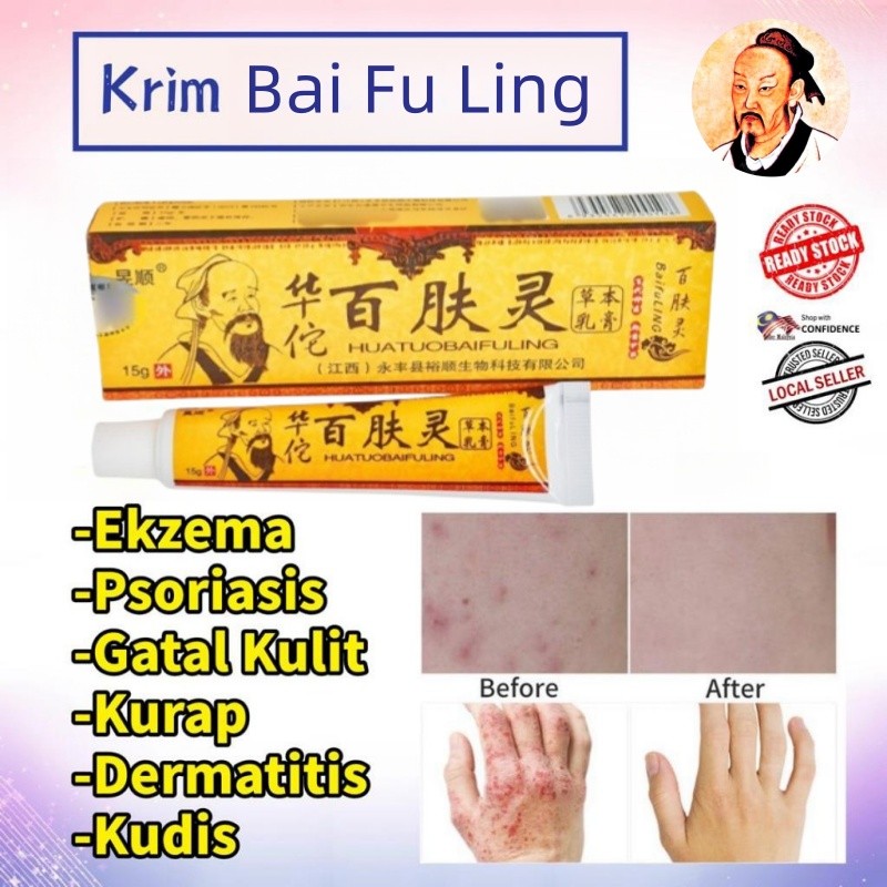 Hot Baifuling Cream Yellow Cream 15g Ubat Kuning Ubat Cina Ubat Kurap Yellow Cream 百膚靈 藥膏 正品