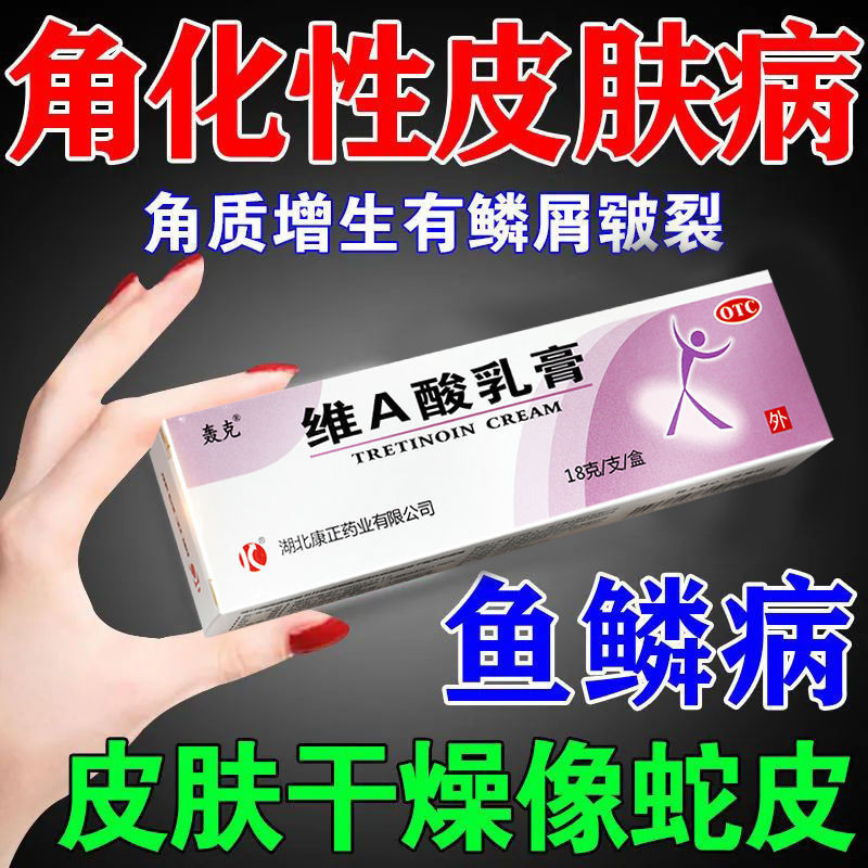 Dry snake skin, flaky skin, dry, rough, keratinous abnormali Fish Scale Disease Vitamin a-a-a-a-a-a-a-a-Acid Cream Caused by dry snake skin, 4-11-8