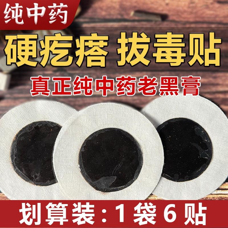 Fire boil detox patch to remove pustules and suck pus, long pustules and hard pimples on bu Fire pimples on bu Drug patch remove pustules pustules pustules Traditional Old Black Cream pustules Handy Tool 8.22