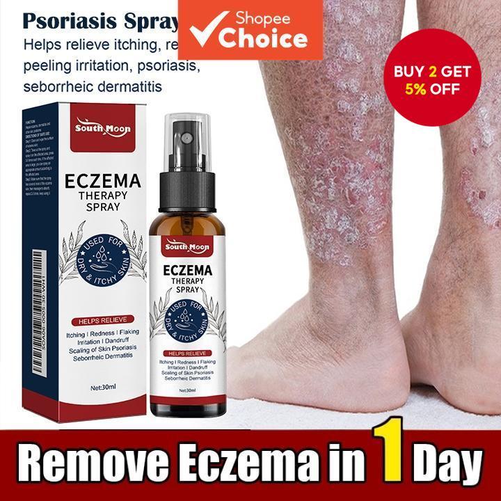 Psoriasis cream 30ml Anti-Itch Remover for Itchy Skin and Bacterial Infections Anti-bacterial  Krim psoriasis 30ml Anti-Gatal Remover Gatal Kulit dan Jangkitan Bakteria Anti-bakteria