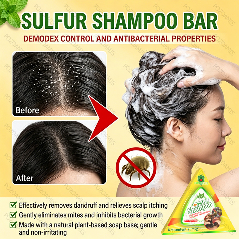Anti Dandruff Shampoo Bar Effective Anti Dandruff Anti Itching Oil Control Prevent Hair Loss Smooth Hair Care