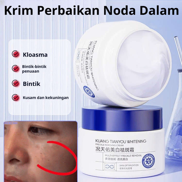 【Visible Brightening in 7 Days】Niacinamide Dark Spot Corrector Cream for Face / Melasma Treatment / Hyperpigmentation Brightening Cream / Whitening Moisturizer with Vitamin B3