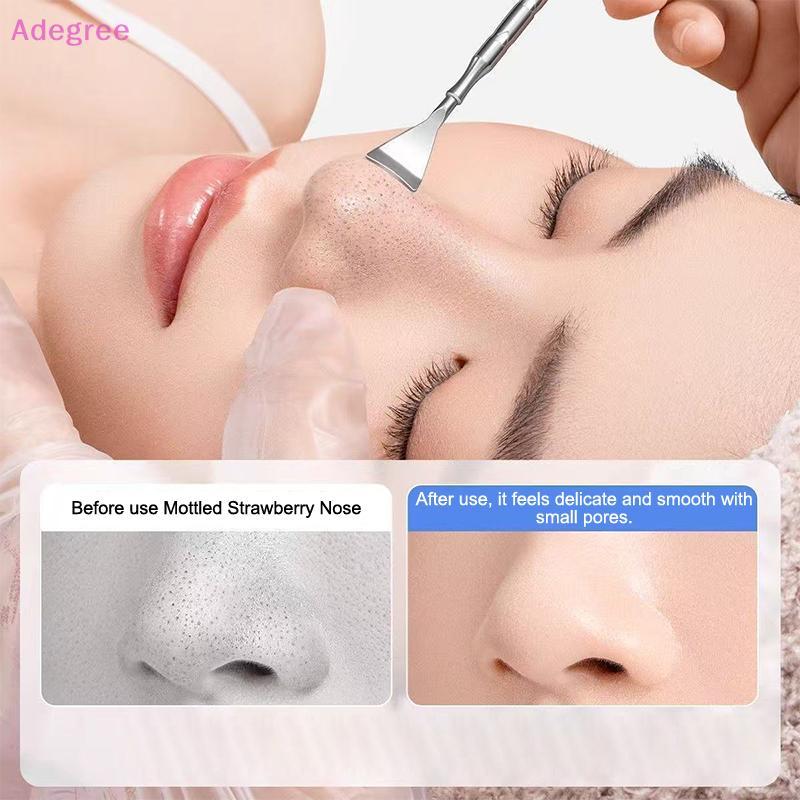 Adegree ckhead Acne Remover Pimple Popper Tool  Removing Hair Follicle Cleaning Whitehead Nose Face Blemish Extractor Cosmetic Tools 