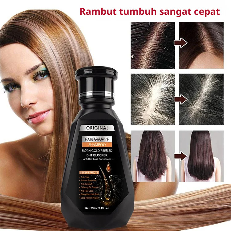 Scalp Health shampoo Shampoo Conditioner Hair condition Promote development Improve hair texture Safe and natural Shampoo Treatment Shampoo Hair Fixing Shampoo Lasting Adults