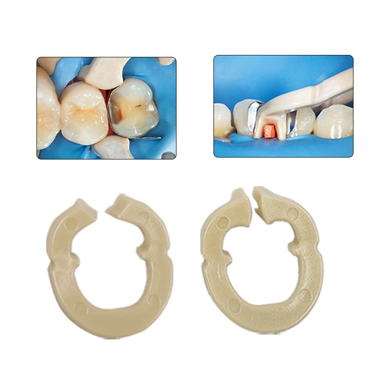 Dental Resin Clamping Ring Separator Ring Sectional Contoured Metal Matrices Holder Matrix Fixed Clamp Dental Tools
