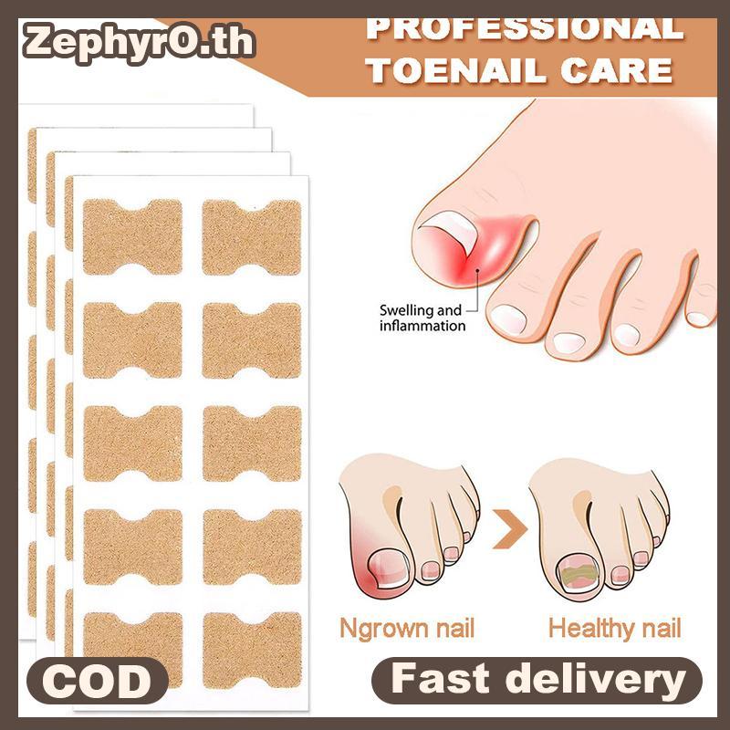null 60Pcs Ingrown Nail Correction Stiers Toenail Corrector Patches Paronychia Treatment Recover Corrector Pedicure Nail Care Tool null