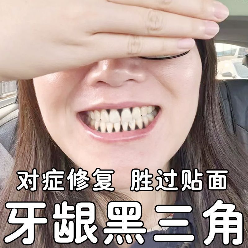 【现货】长期牙龈黑三角敏感出血牙缝发黑变大牙龈退缩牙根外露修复喷剂T1.20