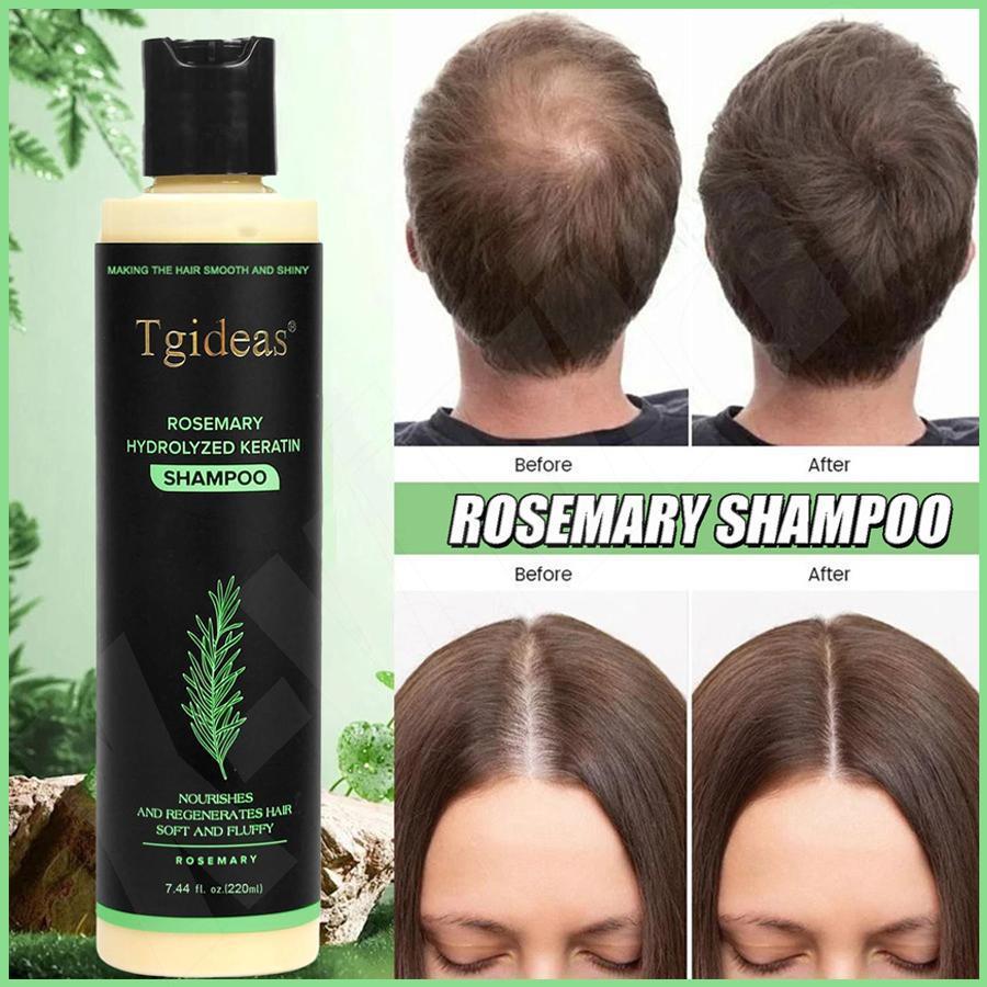 Hair Growth Shampoo 220ml Natural Shine Conditioner Hair Loss Shampoo for Women for Roo…