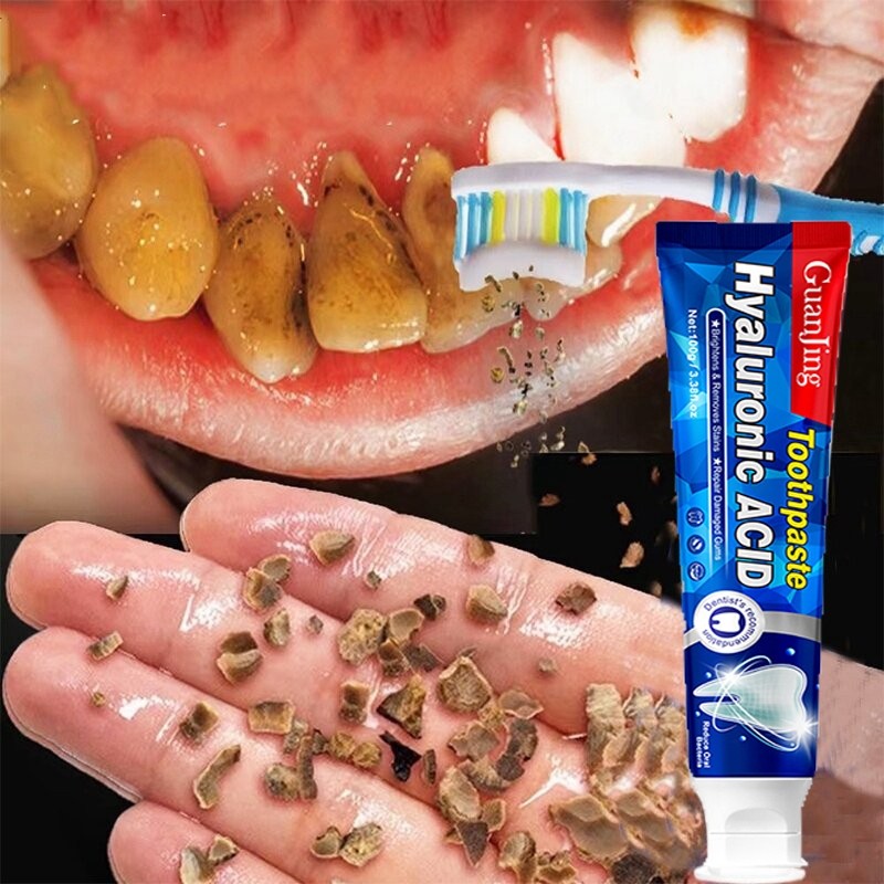 Hyaluronic acid toothpaste Teeth Whitening toothpaste Ubat gigi pemutih putihkan gigi Removal yellow teeth tartar 美白牙膏，，