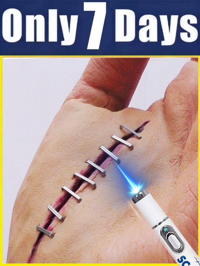 Reduce your worries blue light pen and stop scar about your scar.High Rating,HOT